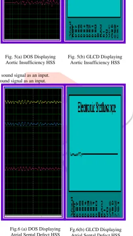 Fig. 5(b) GLCD Displaying Aortic Insufficiency HSS 