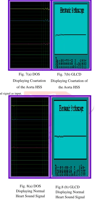 Fig. 7(a) DOS 