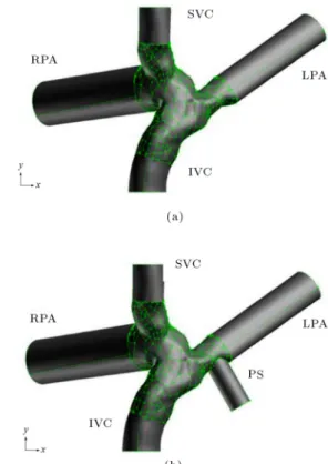 Figure 3. Illustration of the coupled 3D-1D model.