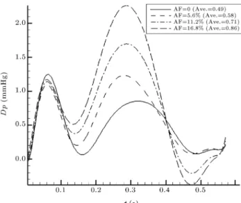 Figure 8. PI changes of LPA and RPA for dierent AFs.