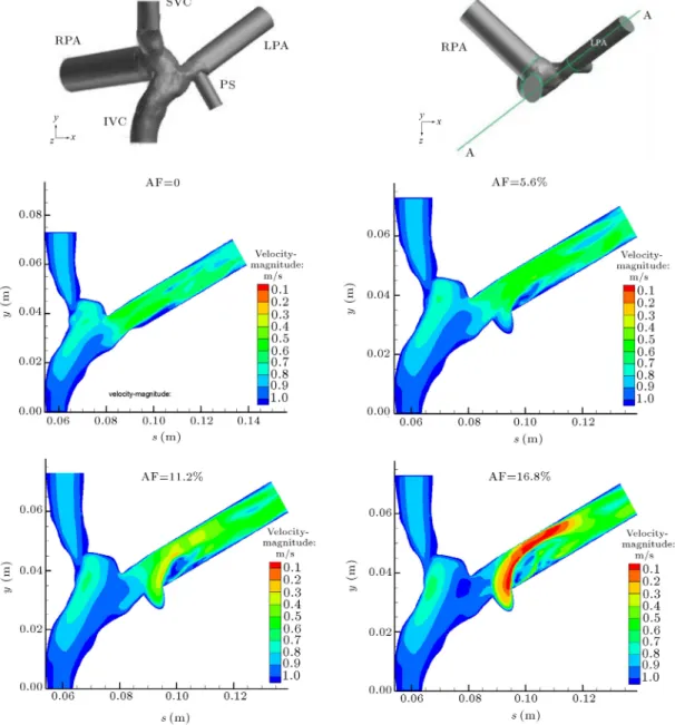 Figure 9. Velocity magnitude contours and streamlines at plane AA.