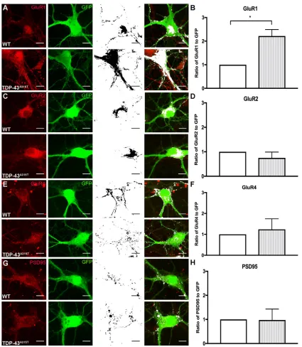 Fig. 4. The effect of TDP-43A315TTDP-43were labeled for postsynaptic receptors and GFP (antibody against GFP enhances endogenous YFP fluorescence)