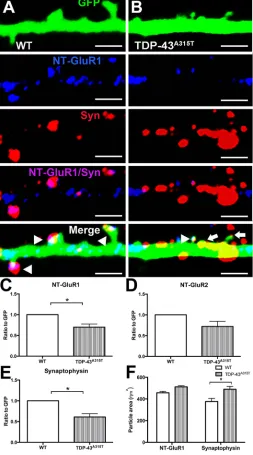 Fig. 5. The effect of TDP-43A315Tof the particle size of NT-GluR1 and synaptophysin demonstrated thatthere was a significant increase in the area of the synaptophysin particlesin TDP-43comparison to WT controls