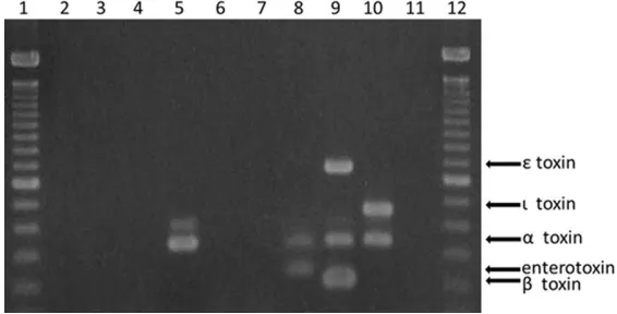 Figure 3. Agarose gel electrophoresis of PCR amplicons obtained using formalin-fixed paraffin-embedded colon tissues from 6 cases (lanes 2-7, Case 5, 10-12, 23, and 25, respectively)