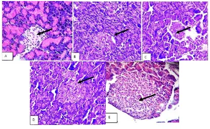 Fig. 2: Pancreatic histology in experimental rats. 