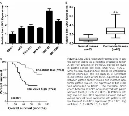 Figure 1. Linc-UBC1 is generally upregulated in gas-tric cancer, acting as a negative prognostic factor