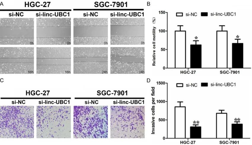Figure 2. Linc-UBC1 knockdown attenuates gastric cancer cell proliferation. A. Linc-UBC1 expression level was confirmed by qRT-PCR in multiple gastric cancer cell lines