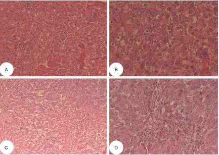 Figure 2. At 72 hours: Haematoxylin and eosin stained paraffin sections showing the hepatic structure of the TAA group (A, B) and EGCG/TAA group (C, D)