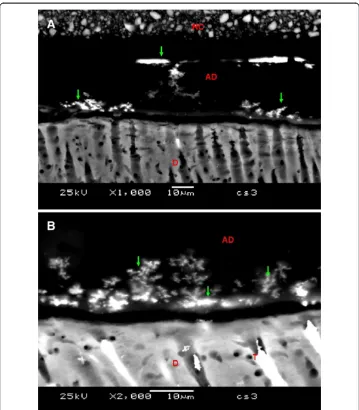 Figure 4 Backscattered images of the CS3 group. In (A) (1000×) nanoleakage (green narrows) wasobserved in the Adhesive Layer “water tree”