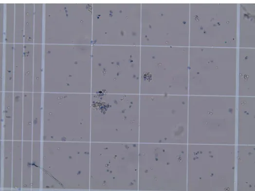 Figure 3.2: Trypan blue exclusion assay with T98G cells drugged with QCT 25 µM +  NaB 1 mM visualized at 10X on a hemocytometer using an Olympus BX53 microscope