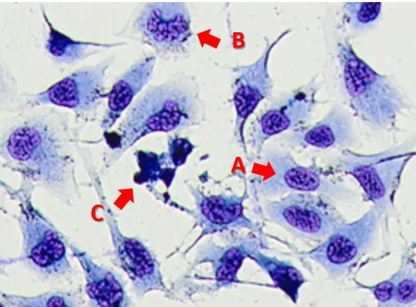 Figure 3.3: Wright staining of T98G GBM cells dosed with QCT 25 µM + NaB 1 mM.   (A) A normal, non-apoptotic cell (B) Cell undergoing early apoptosis showing a crescent shaped nucleus (C) Late apoptotic cells showing complete nuclear condensation and cell 