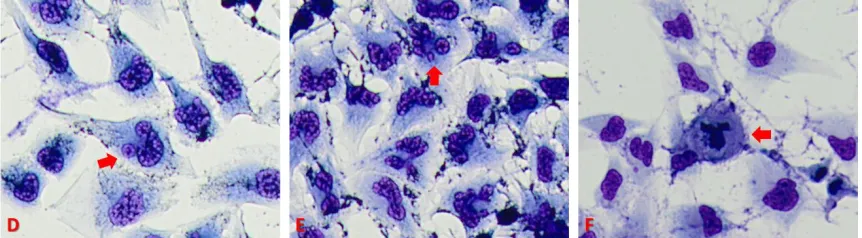 Figure 3.4: Image D shows cell membrane blebbing in T98G GBM cells treated with a 24  hour dose of QCT 25 µM