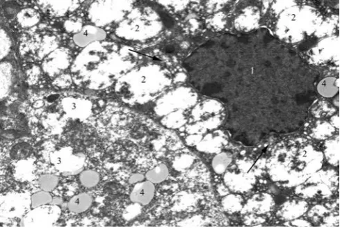 Figure 1. Swelling and teasing of the capsule and loss of integrity of the adrenal zona glomerulosa in juvenile rat under the systematic exposure to 10-day +Gx acceleration