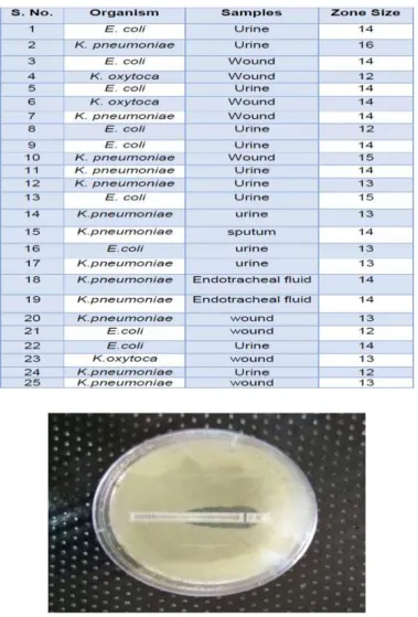 Table 1: Shows Readings of Zone of Inhibition. 