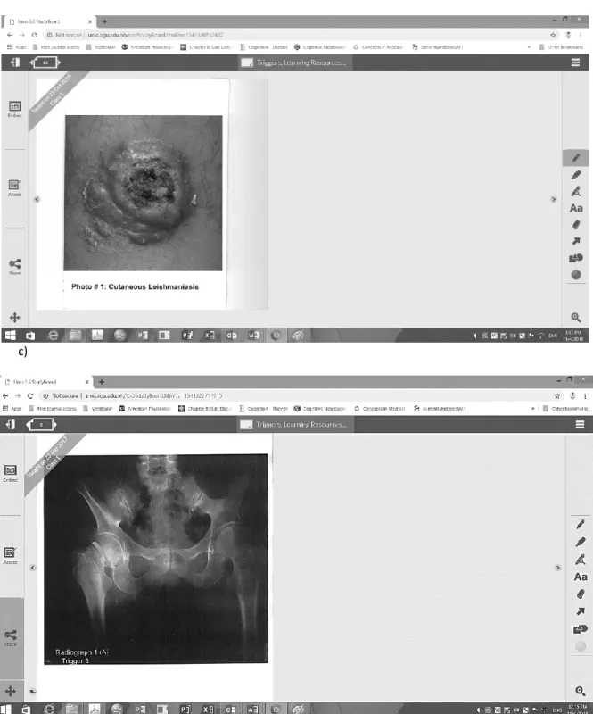 Figure 2: Screen capture of a) embedded text trigger on a single page, b) photo associated with the trigger  (trigger 3 in (a)) embedded on a separate page and c) an example of embedded radiology image 