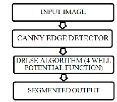 Fig. 1:  Segmentation Block Diagram 