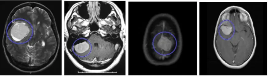 Figure 2: The result of selection of initial contours in MR image 