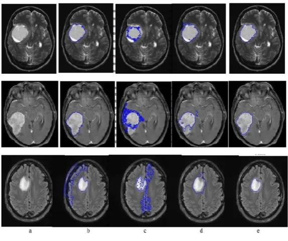 Figure 3: original images and segmentation results of CV, LIF, [16] and proposed method