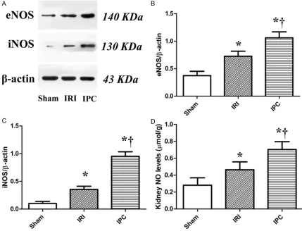 Figure 4. Effects of IPC on renal hemodynamic changes. The renal artery blood flow (RABF) and renal vein blood flow (RVBF) were measured with Doppler ultrasound