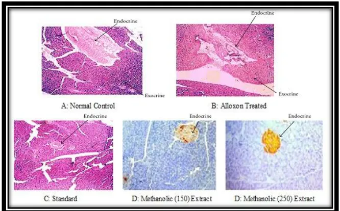 Fig. 4: Biochemical parameters measured for all groups from the blood serum treated withPhyllanthus amarus seeds extract on Alloxan induced Pancreotoxicity 