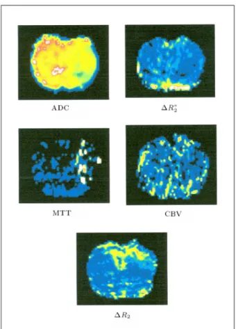 Figure 2. Plots showing the relationship between TCL, D and  R 32 =  R 22 with volume voxel