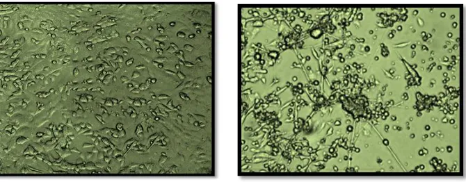 Fig. 1B: Differentiated pc-12 cells 