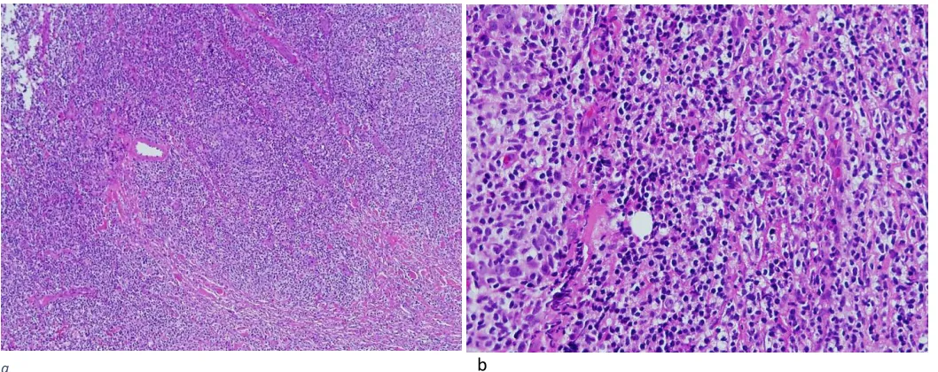 Figure 3. Microscopic findings (hematoxylin-eosin stain)  