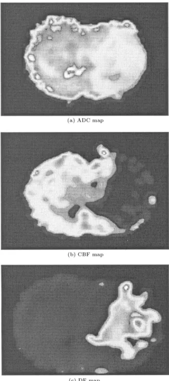 Table 1 depicts the ADC, CBF and r= p ` values.