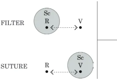 Fig 12. Filter and Suture.