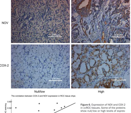 Figure 6. Expression of NOV and COX-2 in ccRCC tissues. Some of the proteins show null/low or high levels of expres-sion (immunohistochemical staining; original magnification ×200)