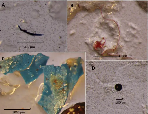 Figure 5A). Out of a total 2772 microplastic particles observed, only one bead was identified