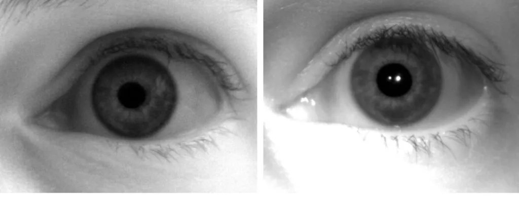 Figure 3.8: Histogram equalized (see 2.1) pictures of the same eye, recorded with the Basler