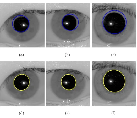 Figure 5.8: Visualisation of the Snake Algorithm in comparison to the Hough Circle Trans-