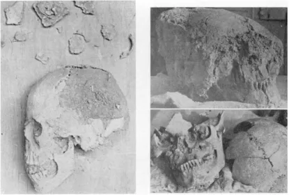 Figure 8. 2 AA, 6 AA (upper right) and 5 AA before cleaning and mending. 