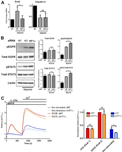 Fig. 5. Assessment of the involvement of HIF1α in hypoxic events regulated by TRPC1. (A) Effect of HIF1A siRNA-mediated silencing on the levels ofhypoxia (24 h)-mediated upregulation of the mesenchymal marker SNAI1, and hypoxia-mediated downregulation of t