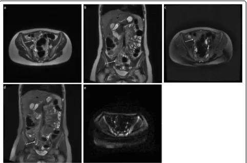 Fig. 4 Five-sequence free breathing MRI on an 8-year-old male patient with radiological findings suggestive of acute appendicitis (M4)