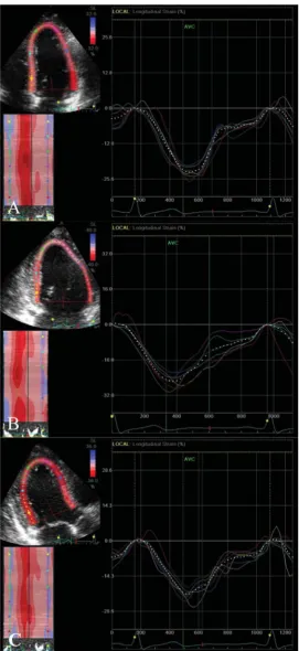 Fig 1. Global longitudinal strain. Peak systolic negative deflection from six segments (basal, mid andapical) from each view A