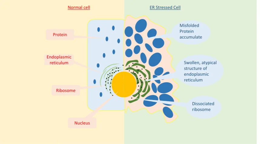 Figure 2.Figure 2. Comparison between a normal and ER stressed cell. Compared to the normal cell, the ERstressed cell exhibits a significant difference in the ER structure, including luminal swelling and a dissociated ribosome