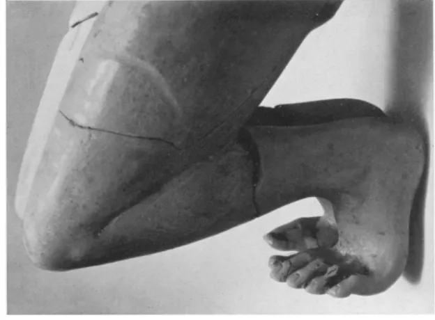 Fig. 7. The Kileeling Boy. Detail of Feet 