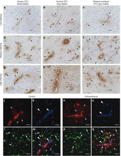 Figure 1.Endogenous IgG antibodies are present in low (halo (open arrows) from blood vessels overlaps with processes of some neurons