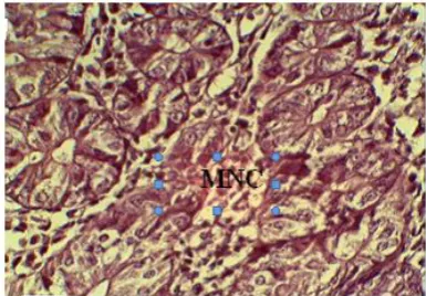 Fig 7: Histopathological section of spleen of mice  treated with 100 mg / kg body weight showed: red pulp infiltration of mononuclear cell (MNC) mainly macrophage and plasma cell
