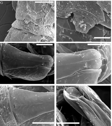 Figure 9. Scanning electron microscope images of Microcharon tanakai sp. n., G pereonite 7 and free ple-onite, ventral, paratype male H penial papillae, ventral, I pleopod 1, dorsal, J distal part of male pleopod 1, dorsal K proximal part of male pleopod 1