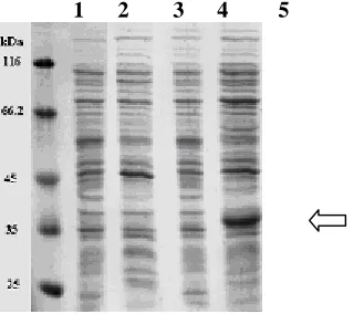 Figure - 4: A) Confirmatiom of Pfu PCR product by restriction pattern using HhaI(Hin6I) restriction enzyme on 2% agarose
