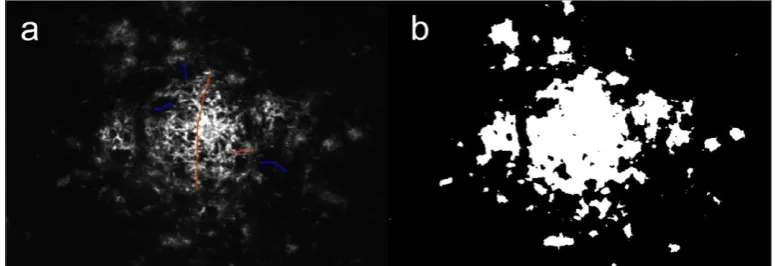 Figure 2: Confocal fluorescence image of MOAB2 labelled amyloid-β pathology in APPswe/PS1dE9 mouse brain tissue with sparse annotations for signal (red) and background (blue) (a) and resulting segmentation (b).