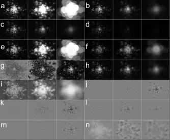 Figure 3: Confocal fluorescence image of MOAB2 labelled amyloid-β pathology in APPswe/PS1dE9 mouse brain tissue with image filters applied