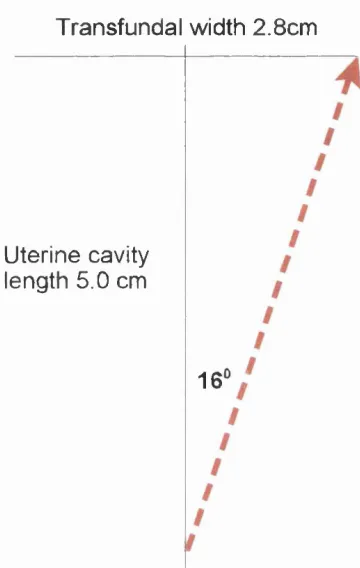Figure 3.18 Using the ultrasound study the angle of deflection that would 