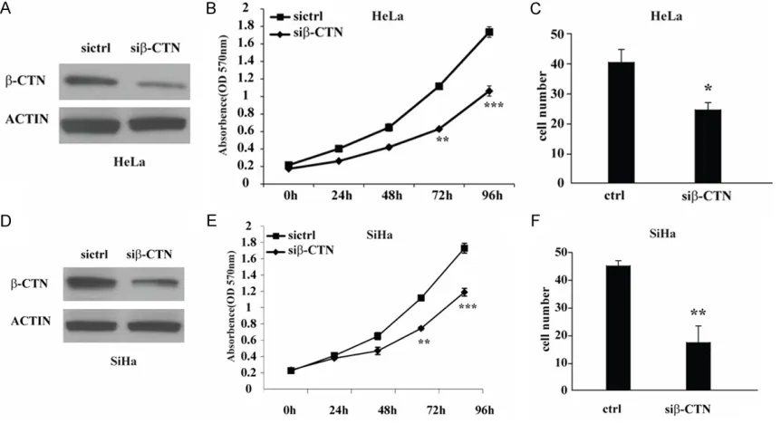 Figure 4. β-catenin knockdown attenuates the increasing proliferation of cervical cancer cells induced by SOX14
