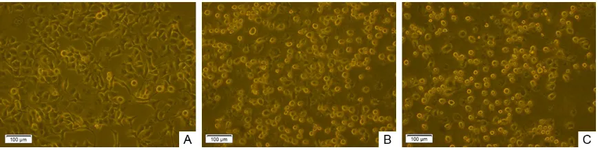 Figure 2. Effects of Celebrex on invasive and migration ability of PANC-1 cell. A, E: Solvent control; B, F: Celecoxib 20 μmol/L; C, G: Celecoxib 60 μmol/L; D, H: Celecoxib 100 μmol/L.