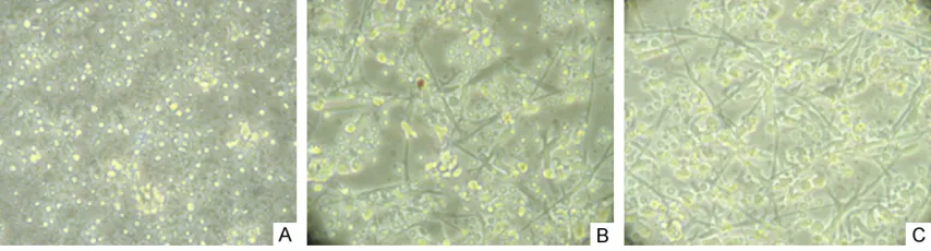 Figure 1. The morphology of DCs in different groups on the 7th day (× 400). A. IFN-λ1 group: No morphological changes of the adherent cells were observed