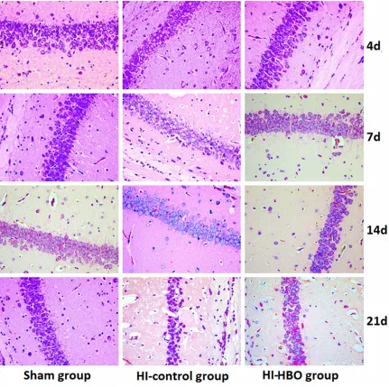Figure 1. Pathologic damage in hippocampal DG region after HI in neonatal rats (HE × 400).